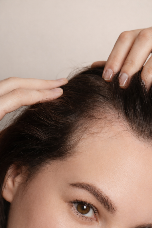 Cuero cabelludo con signos de alopecia androgenética en la raíz del pelo