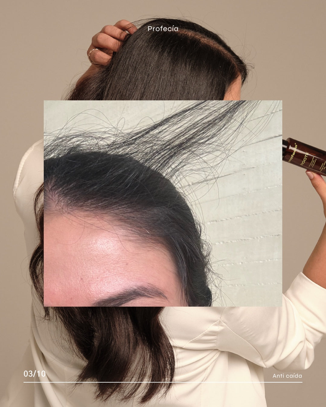 SERÚM ROOTS CON TETRAPEPTIDOS / CRECIMIENTO (capixyl).