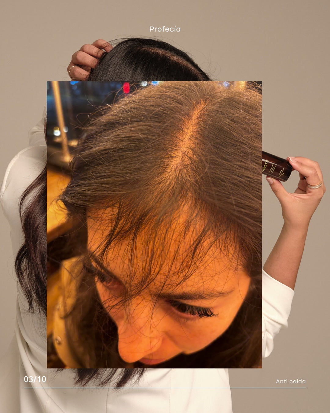 SERÚM ROOTS CON TETRAPEPTIDOS / CRECIMIENTO (capixyl).