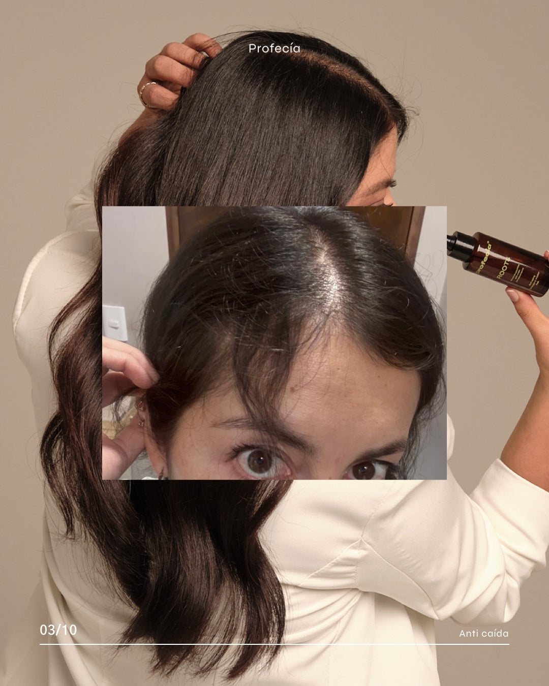 SERÚM ROOTS CON TETRAPEPTIDOS / CRECIMIENTO (capixyl).