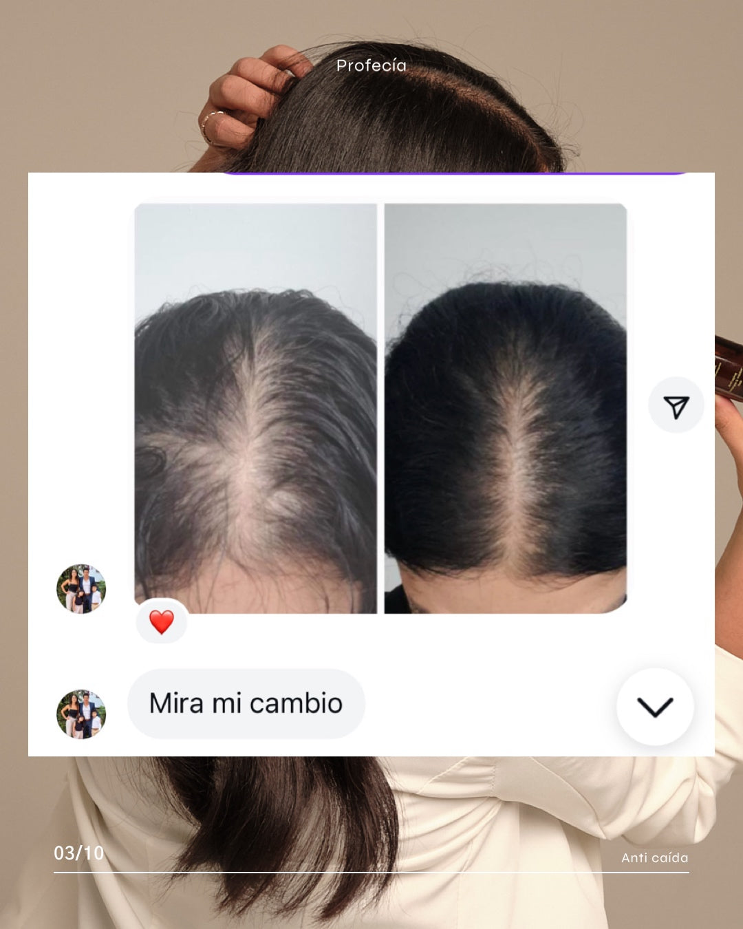 SERÚM ROOTS CON TETRAPEPTIDOS / CRECIMIENTO (capixyl).