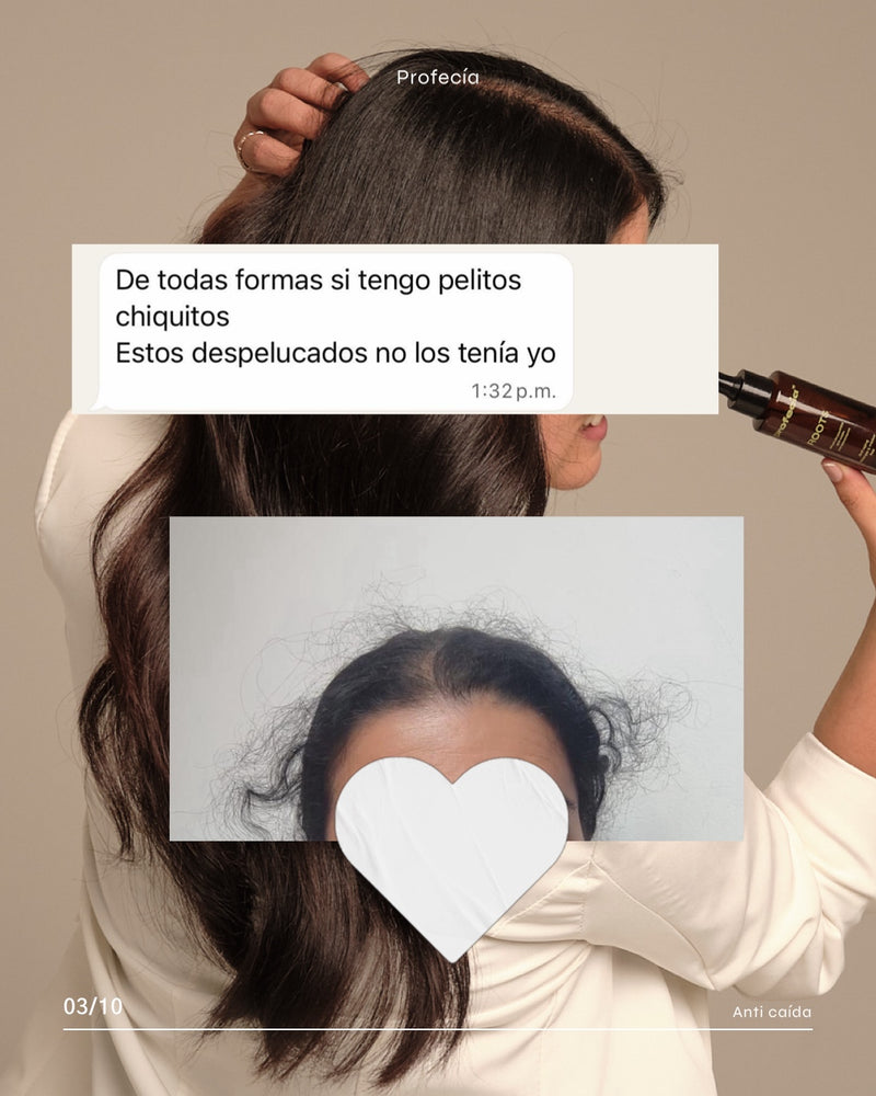 Hombre usando sérum Roots Profecía para detener alopecia