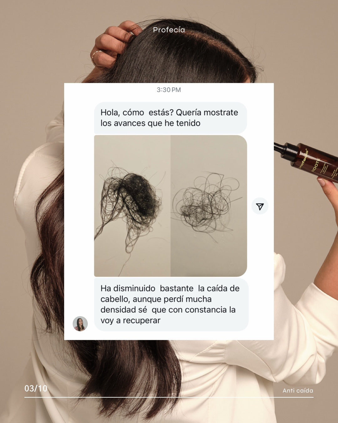 SERÚM ROOTS CON TETRAPEPTIDOS / CRECIMIENTO (capixyl).