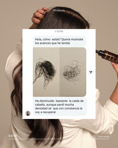 SERÚM ROOTS CON TETRAPEPTIDOS / CRECIMIENTO (capixyl).