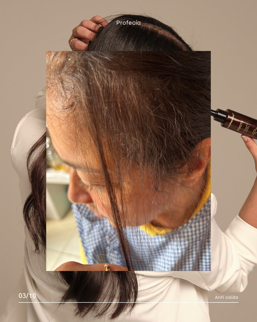 SERÚM ROOTS CON TETRAPEPTIDOS / CRECIMIENTO (capixyl).