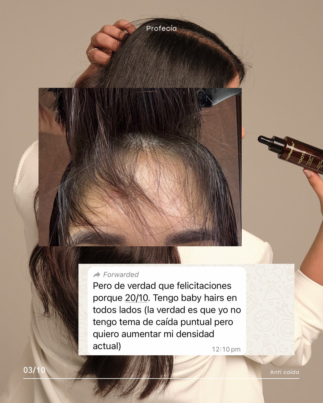 SERÚM ROOTS CON TETRAPEPTIDOS / CRECIMIENTO (capixyl).