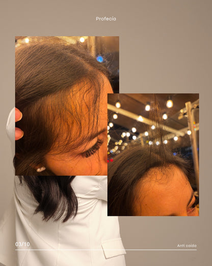 SERÚM ROOTS CON TETRAPEPTIDOS / CRECIMIENTO (capixyl).